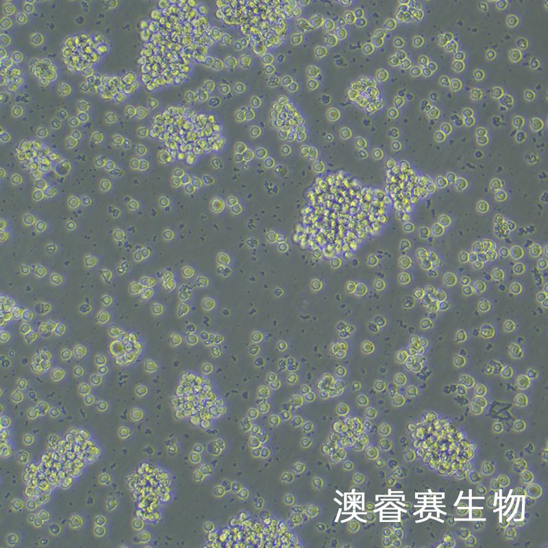 Jurkat（人急性T淋巴細(xì)胞白血病細(xì)胞）,Jurkat