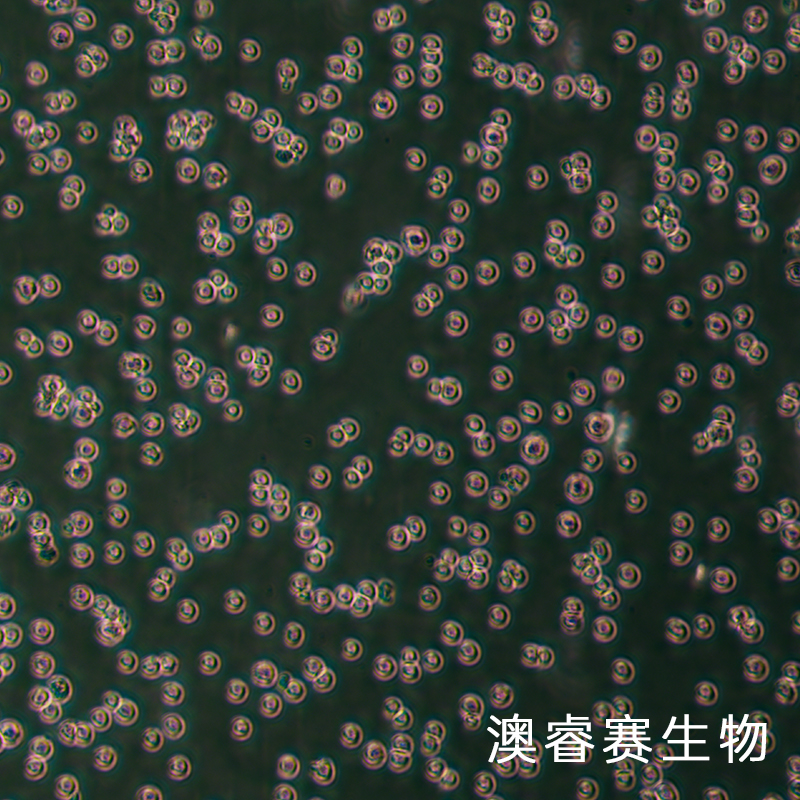 REC-1（人淋巴瘤細(xì)胞（B細(xì)胞非霍奇金淋巴瘤））,REC-1