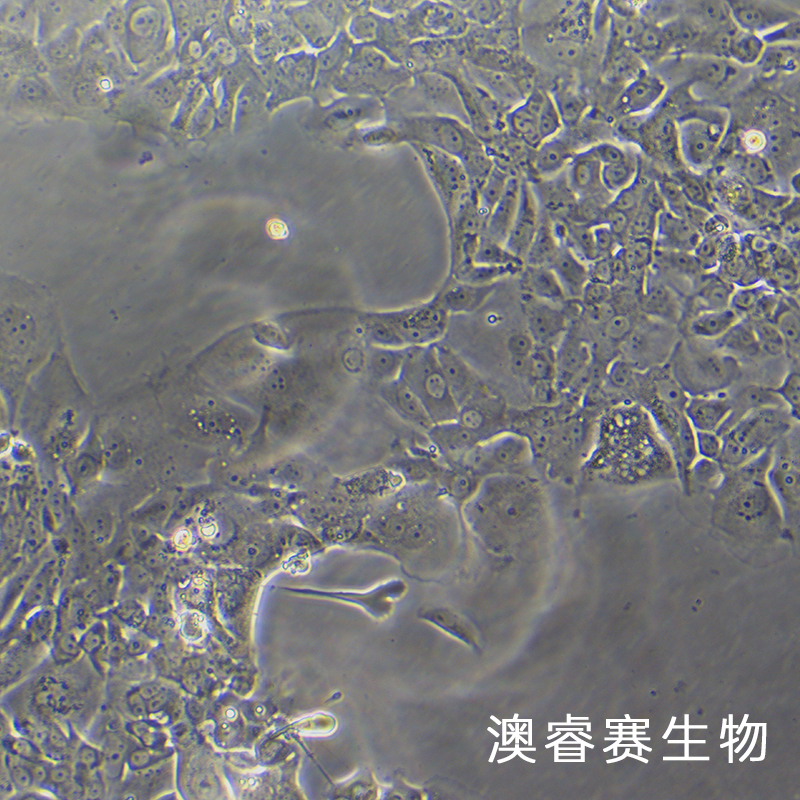 NCI-H1734（人非小细胞肺癌细胞）,NCI-H1734