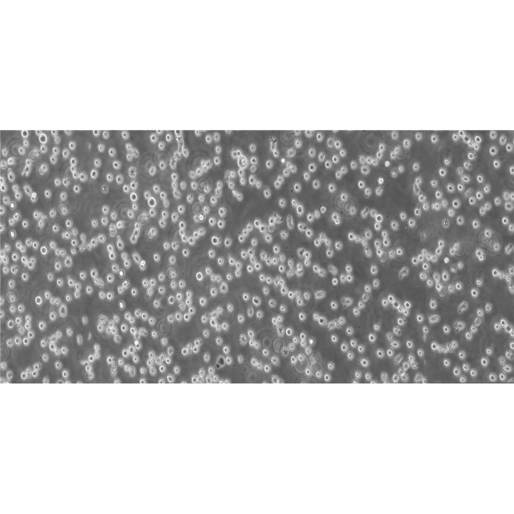 Ku812 Cells人外周血嗜堿性白血病細胞專業(yè)保種|STR圖譜,Ku812 Cells