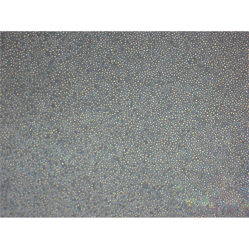 CAL-51 Cells人乳腺癌细胞专业保种|STR图谱,CAL-51 Cells