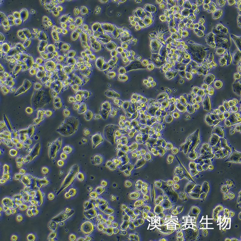 MDA-MB-134-VI（人乳腺导管癌细胞）,MDA-MB-134-VI