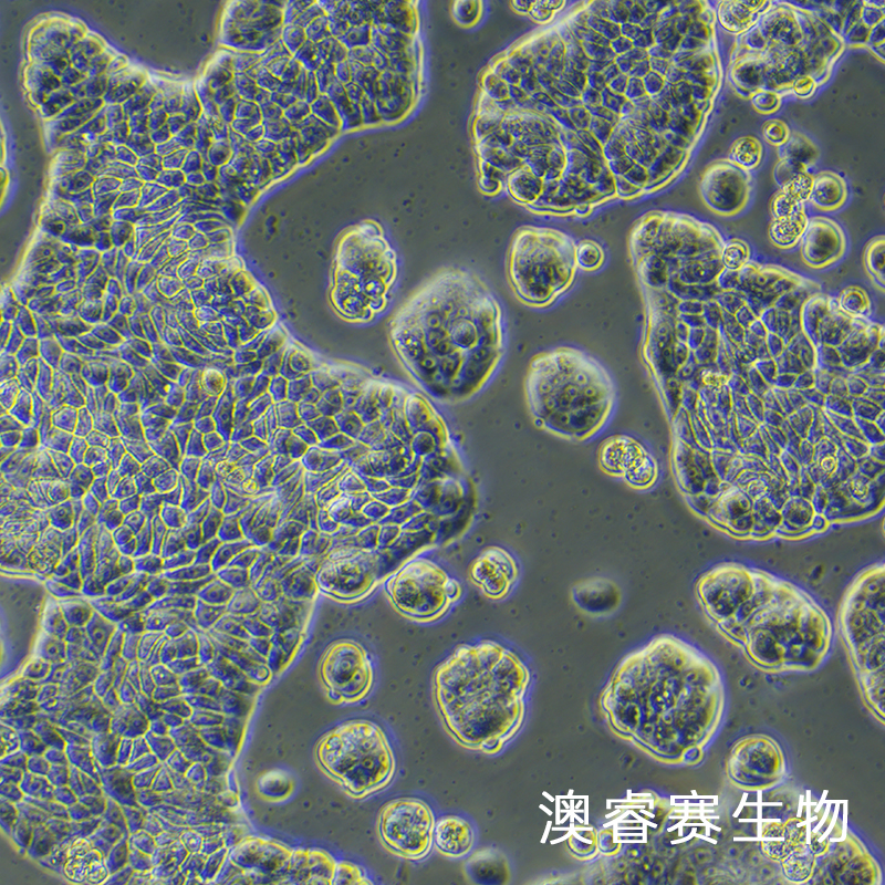 UACC-812（人乳腺导管瘤细胞）,UACC-812