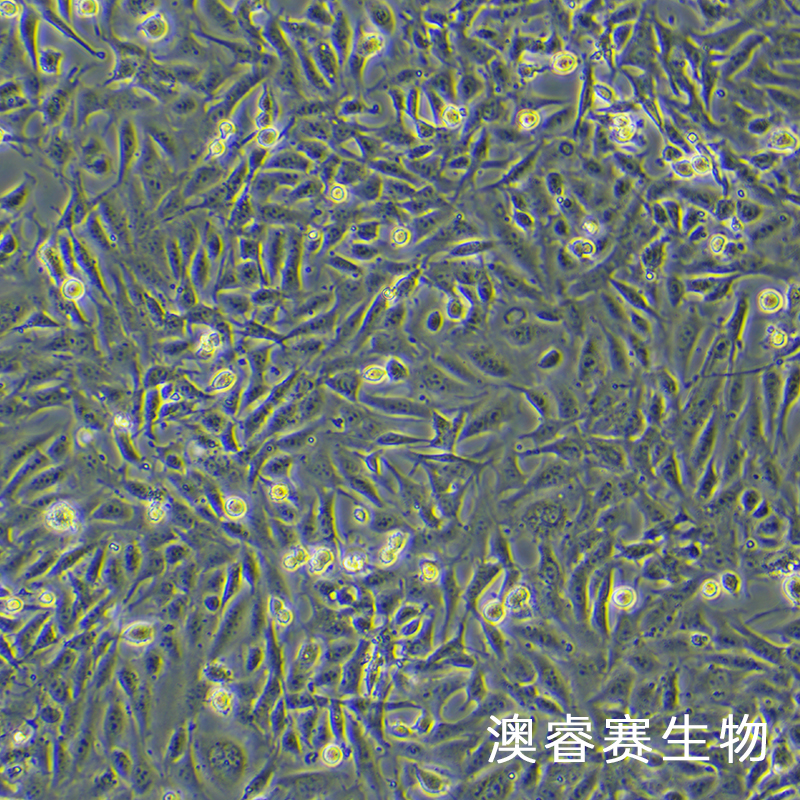 SV40-MES-13（小鼠腎小球系膜細(xì)胞）,SV40-MES-13