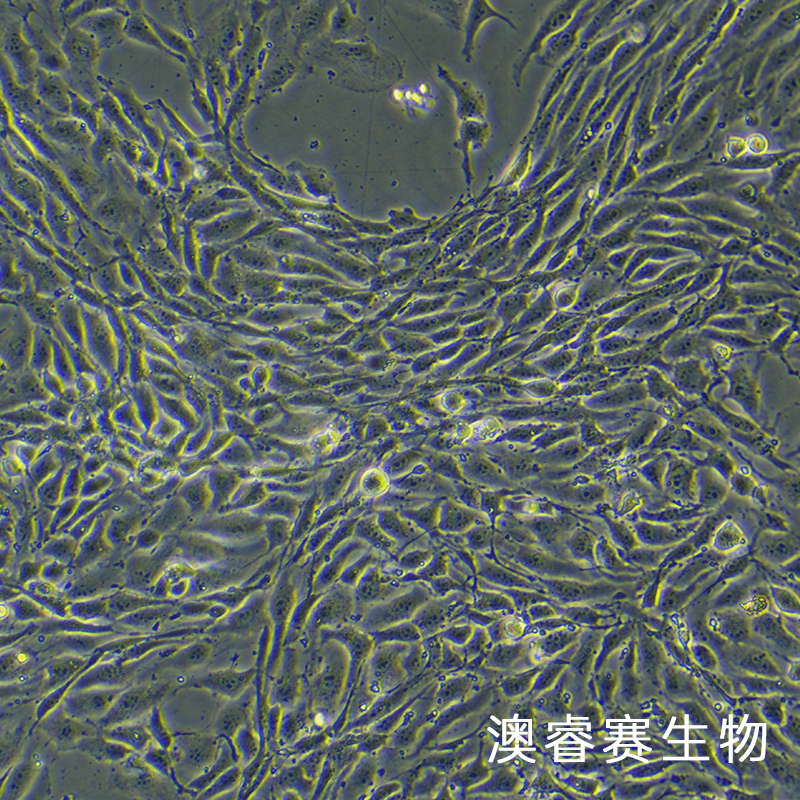 bend.3（小鼠脑微血管内皮细胞株）,bend.3