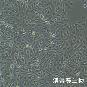 tpc-1（人甲状腺乳头状细胞）,tpc-1