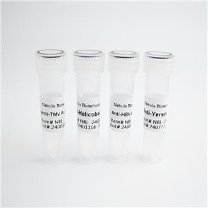 Tau441蛋白 | Recombinant Human Tau441