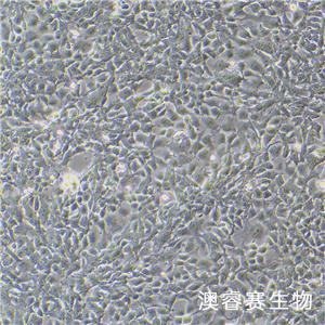 PA-1（人卵巢畸胎瘤细胞）