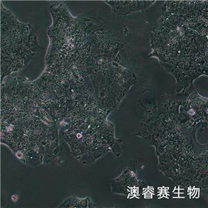 NCI-H2170（人肺鳞癌细胞）