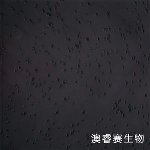 NCI-H69（人小细胞肺癌细胞）