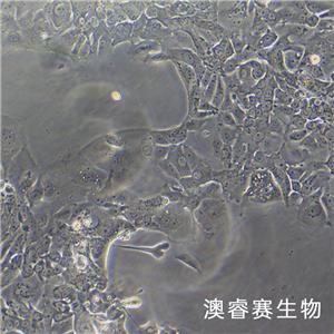 NCI-H1734（人非小细胞肺癌细胞）,NCI-H1734