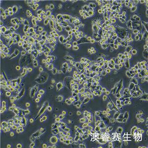 MDA-MB-134-VI（人乳腺导管癌细胞）