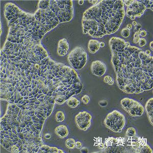 UACC-812（人乳腺导管瘤细胞）,UACC-812