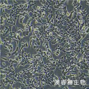 Min6（小鼠胰岛β细胞）