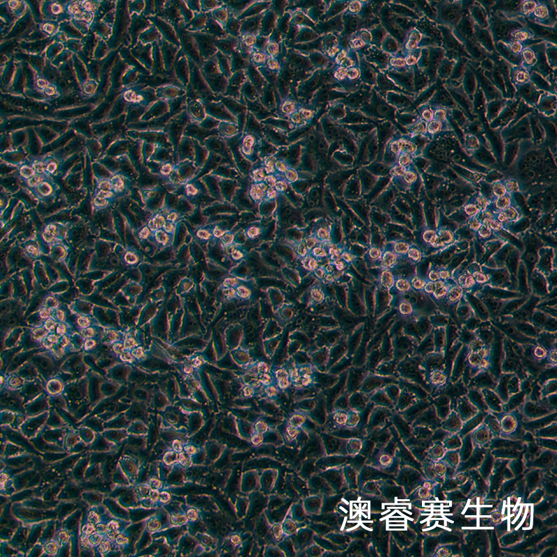 PATU8988T（人胰腺癌细胞）,PATU8988T