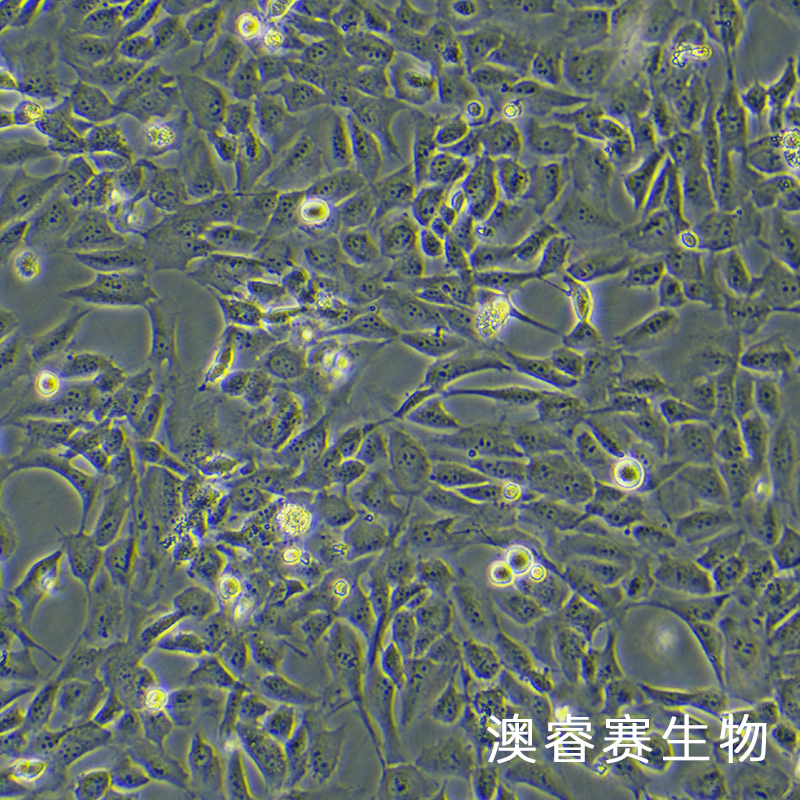 WPMY-1（人正常前列腺基质永生化细胞）,WPMY-1