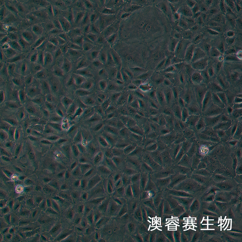 SW 1990（人胰腺癌细胞）,SW 1990