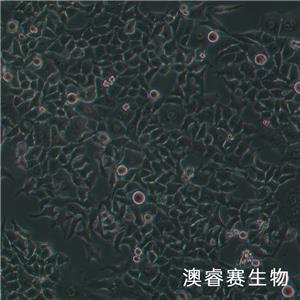 CNE（人鼻咽癌细胞）