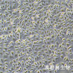 B16-F0（小鼠黑色素瘤细胞）