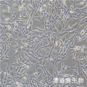 Renca [RenCa]（小鼠肾癌细胞）,Renca [RenCa]