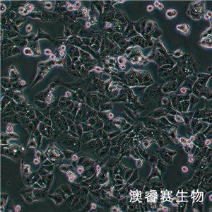 MHCC97-L（人低转移肝癌细胞）