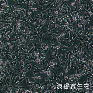 SK-N-BE2（人神经母细胞瘤细胞）,SK-N-BE2