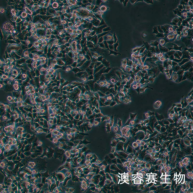 NCI-H520（人肺鳞癌细胞）,NCI-H520