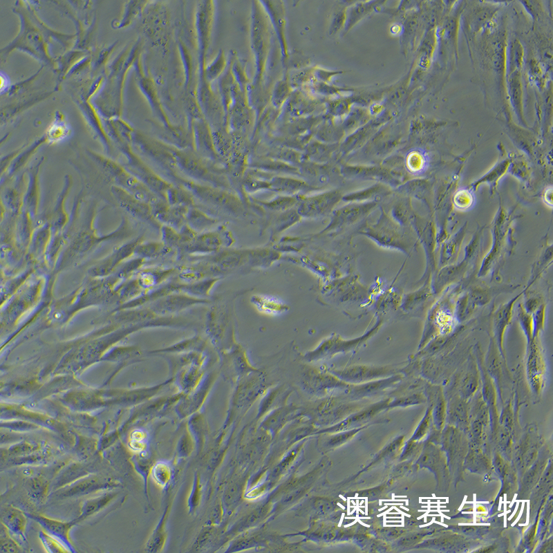 hFOB 1.19（人SV40转染成骨细胞）,hFOB 1.19