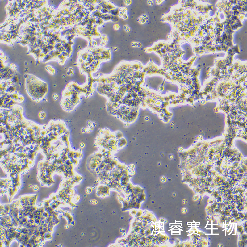 BETA-TC-6（小鼠胰岛素瘤胰岛β细胞）,BETA-TC-6