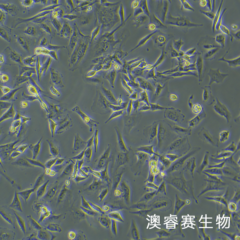 U-87 MG（人脑星形胶质母细胞瘤细胞）,U-87 MG