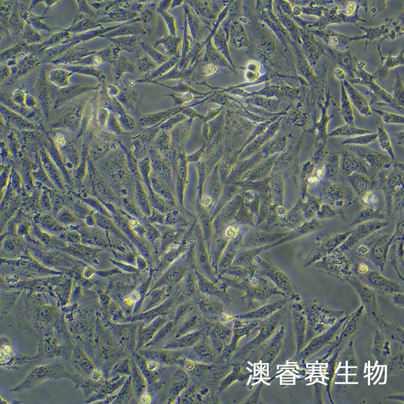 Saos-2（人成骨肉瘤细胞）,Saos-2