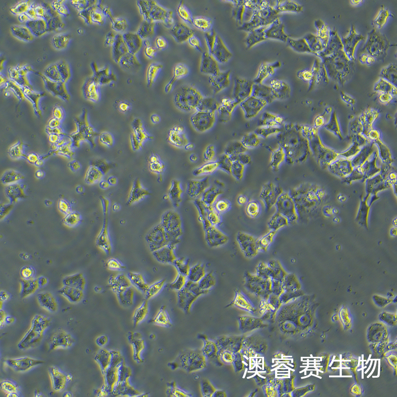 RH-35（大鼠肝癌细胞）,RH-35