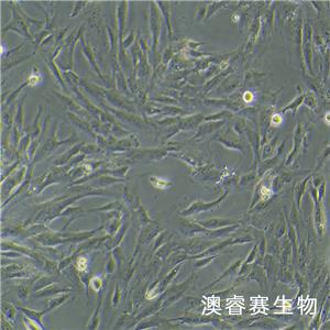 hFOB 1.19（人SV40转染成骨细胞）,hFOB 1.19