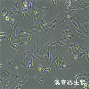 Vero（非洲绿猴肾细胞）