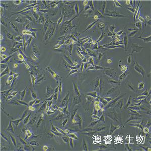 U-87 MG（人脑星形胶质母细胞瘤细胞）