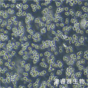 SP2/0（小鼠骨髓瘤细胞）