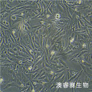 Saos-2（人成骨肉瘤细胞）