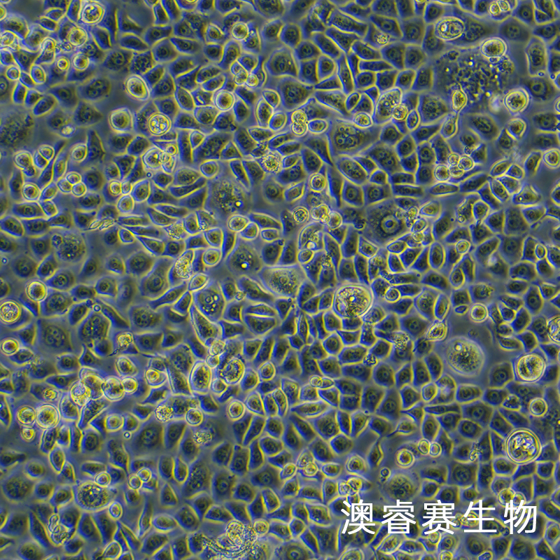ME-180（人子宮頸表皮癌細(xì)胞）,ME-180