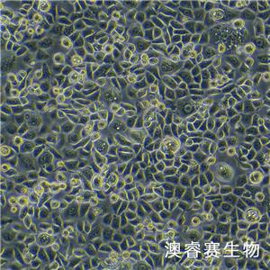 ME-180（人子宫颈表皮癌细胞）