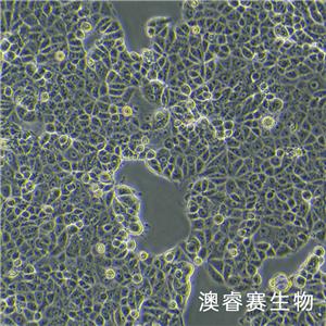 MCF7 [MCF-7]（人乳腺癌细胞）,MCF7 [MCF-7]