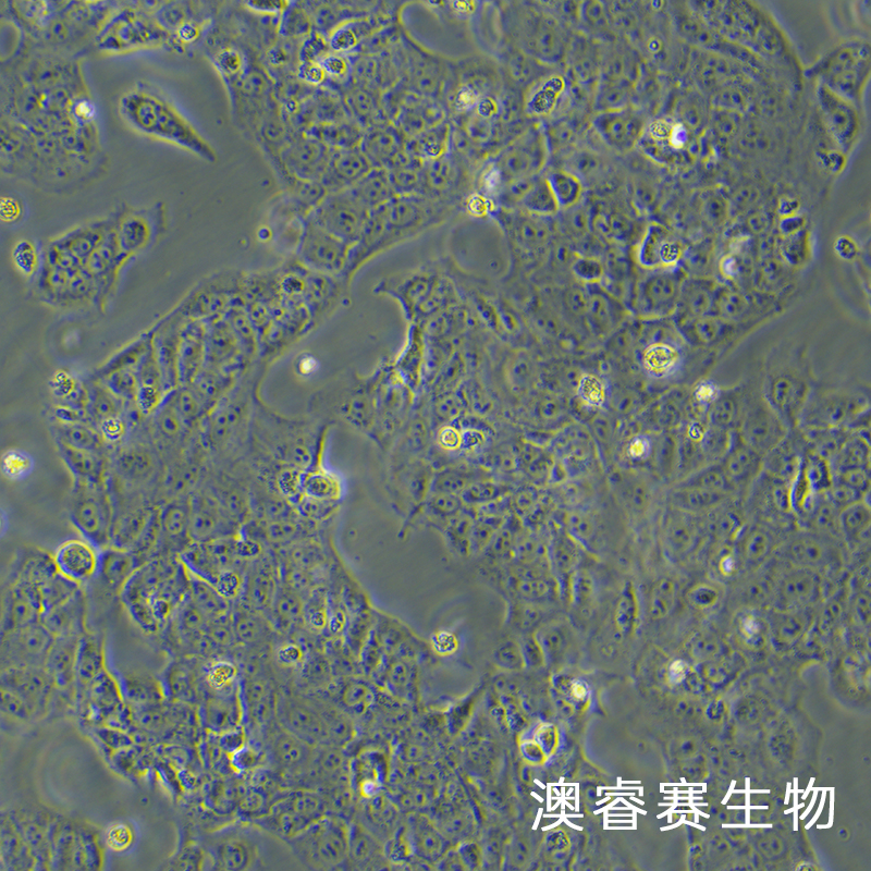 JEG-3（人绒毛膜癌细胞）,JEG-3