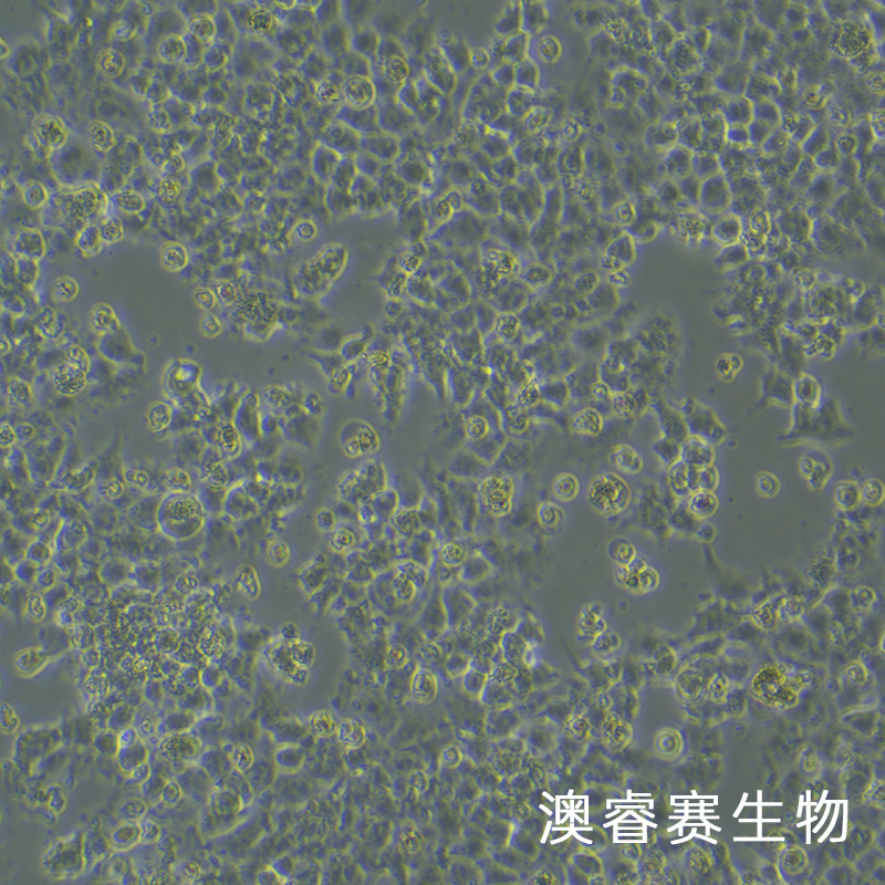 JAR（人胎盘绒毛癌细胞）,JAR