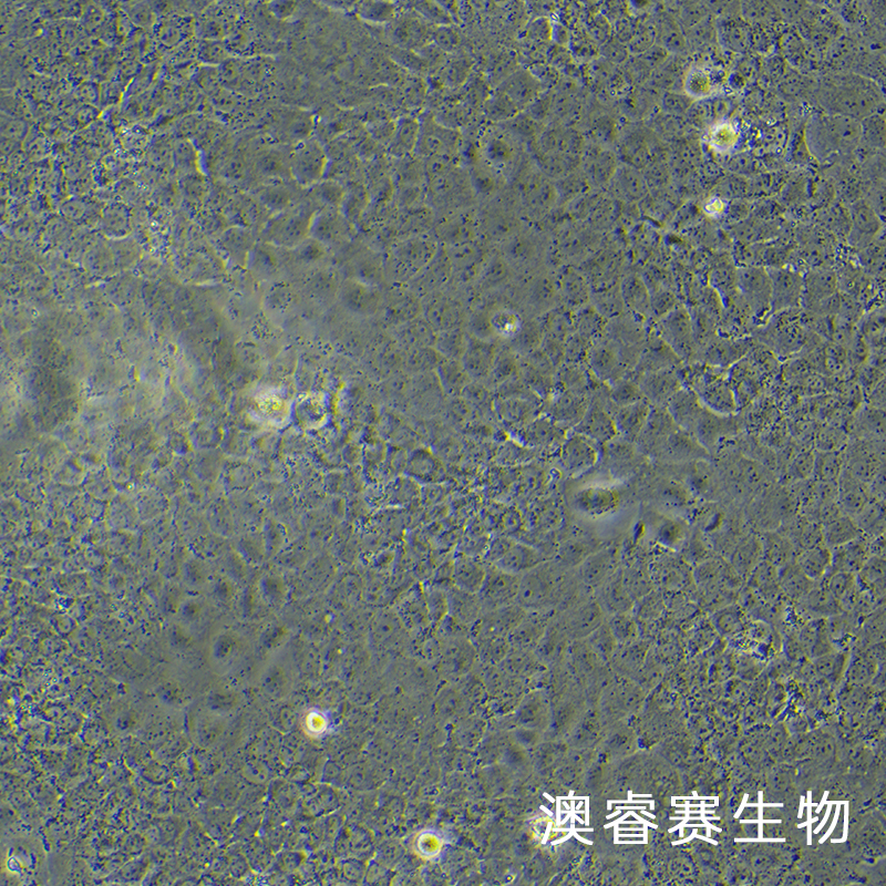 HuH-7（人肝癌细胞）,HuH-7