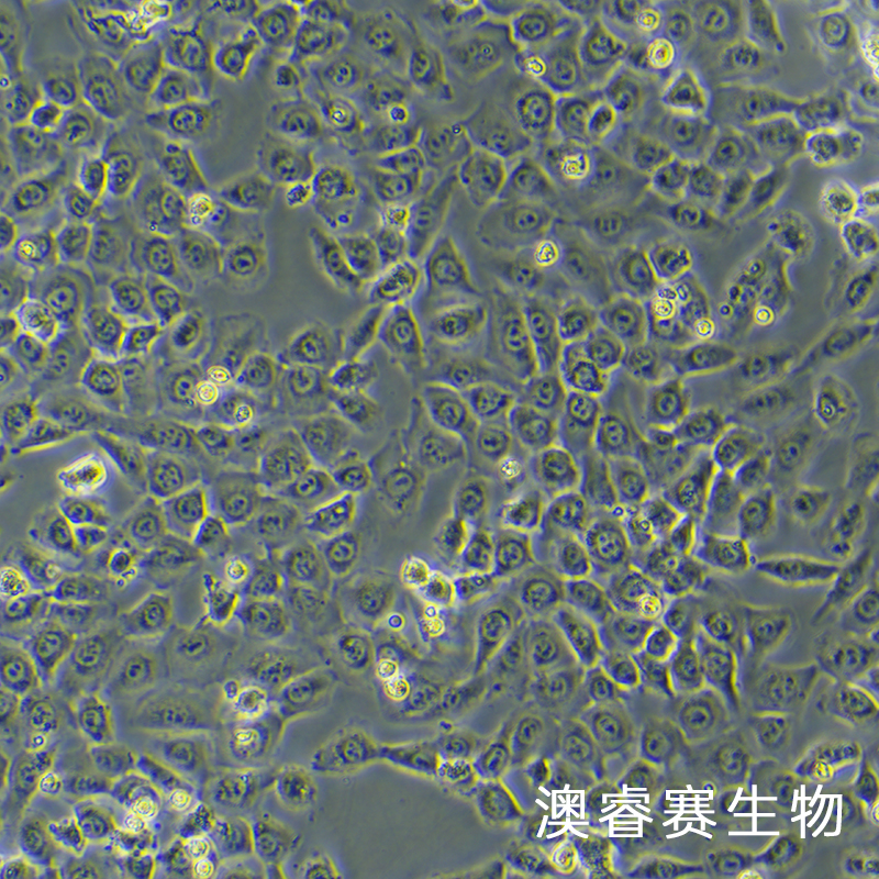 HT-1080 [HT1080]（人纤维肉瘤细胞）,HT-1080 [HT1080]