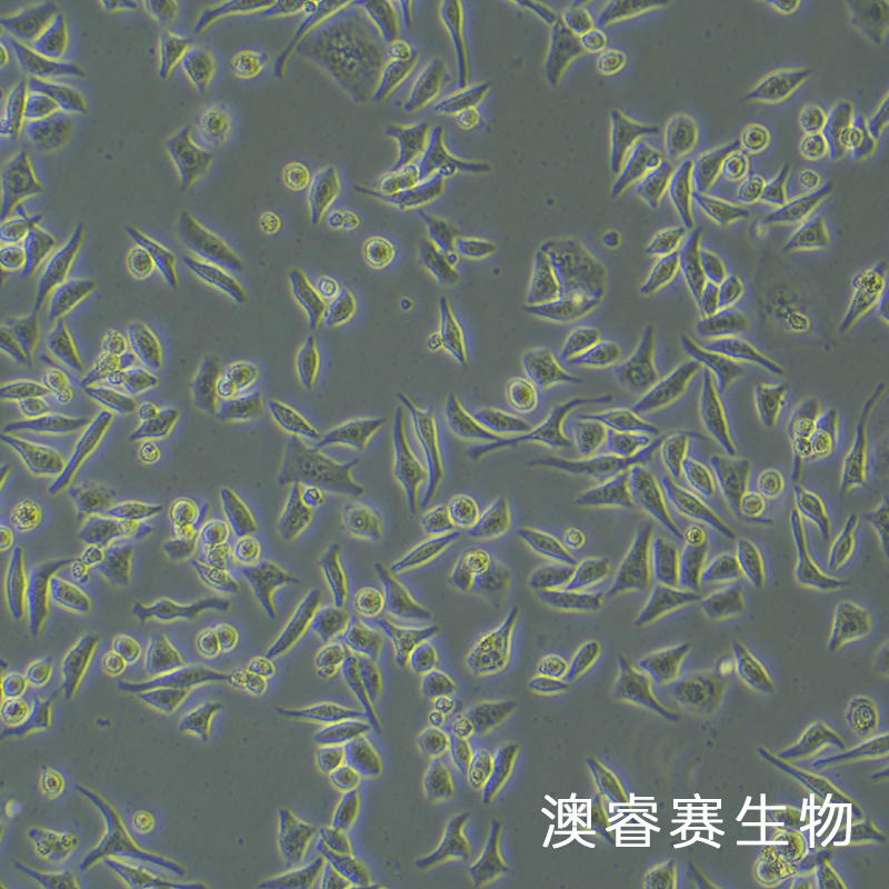 Hela（人宫颈癌细胞）,Hela