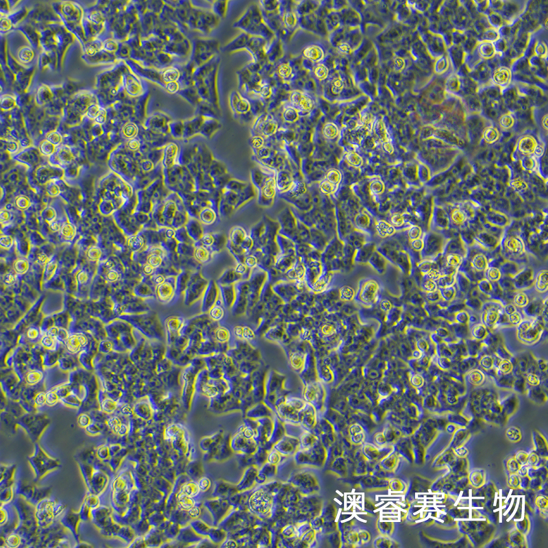 BIU-87（人膀胱癌细胞）,BIU-87