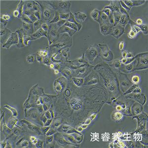 KLE（人子宫内膜癌细胞）