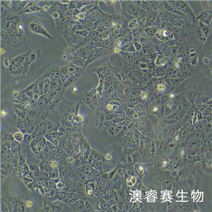 JEG-3（人绒毛膜癌细胞）