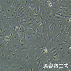 HUV-EC-C [HUVEC]（人脐静脉血管内皮细胞）