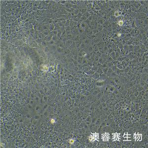 HuH-7（人肝癌細胞）
